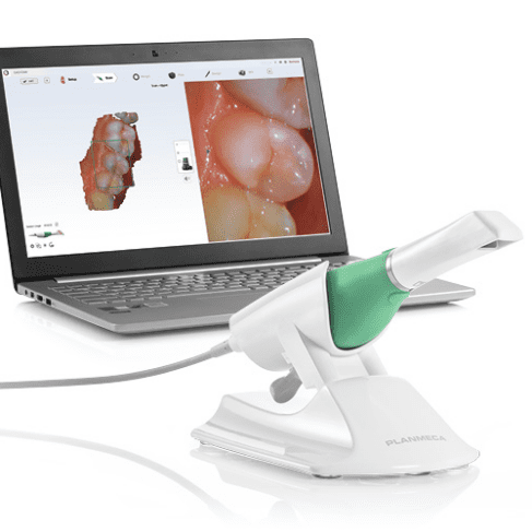 Planmeca Emerald™ Intra Oral Scanner